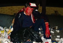 Активісти викинули у смітник столичного нардепа-фальсифікатора Пилипишина