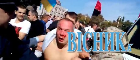 Активісти «Правого сектору» сильно побили Нестора Шуфрича в Одесі