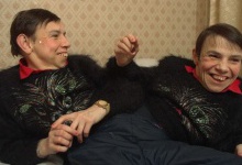 Російські сіамські близнюки спилися, а киргизьких розділили