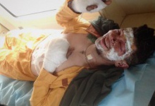 19-річний боєць ДУК ПС отримав поранення у Пісках, після того як ворожий танк розстріляв українські укріплення