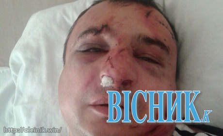 У Києві побили луганського сепаратиста Клінчаєва