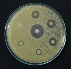 Людству загрожує смертельна небезпека — бактерії все менше бояться антибіотиків