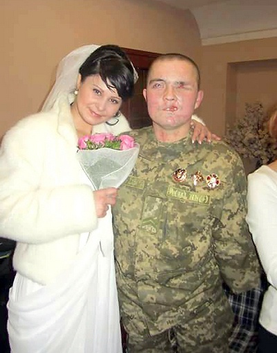 Боєць, якому лікарі не давали шансів на життя, одружився
