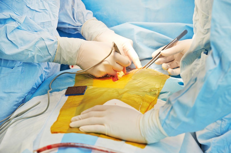 Верховна Рада ухвалила закон про трансплантацію
