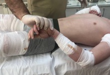 Лікар з Вінниці ставить на ноги дітей із ДЦП за власною унікальною методикою