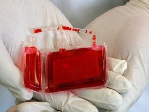 Луцькі лікарі рекомендують зберігати пуповинну кров дитини