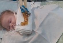 Досі не вийшла з критичного стану 2-річна дівчинка з Луцька, яку паралізувало від пневмонії