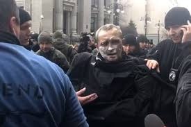 У Києві біля Офісу Президента чоловік підпалив себе