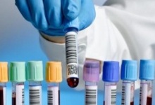 Лабораторія в Лондоні підтвердила коронавірус у чернівчанина