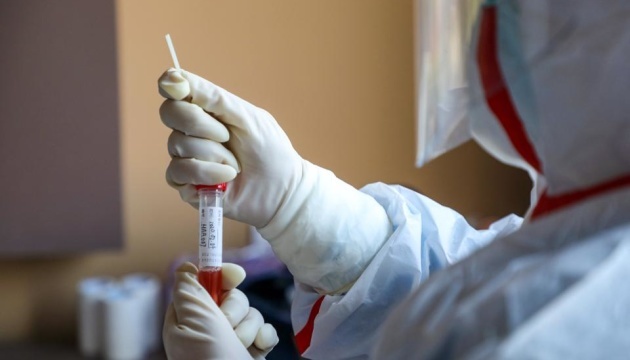 Відомі результати аналізів госпіталізованого у Луцьку з підозрою на коронавірус турка