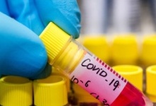 На Вінниччині підтвердили перший випадок коронавірусу