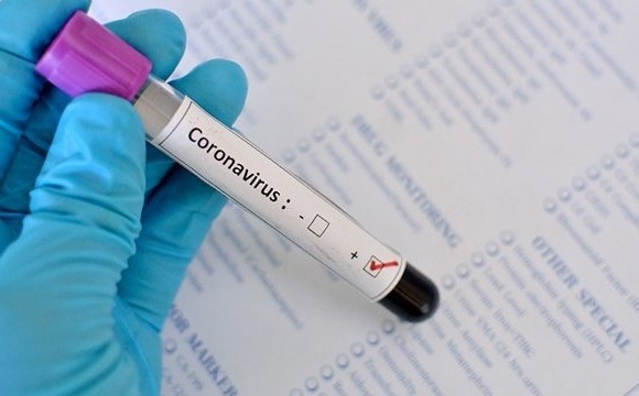 У Чернівецькій області зафіксували ще 4 хворих на коронавірус