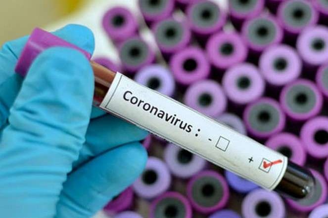 В Україні майже 200 хворих на коронавірус