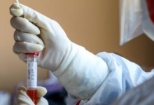 В Україні 93 людини померли від коронавірусу, усього інфікованих – 3102