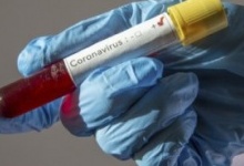 В Україні - 5449 випадків захворювання на коронавірус, померлих - 141