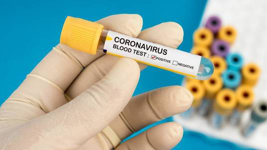 В Україні запустять масове ІФА-тестування на антитіла до коронавірусу