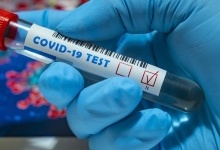 В Україні за добу виявили 656 хворих на коронавірус