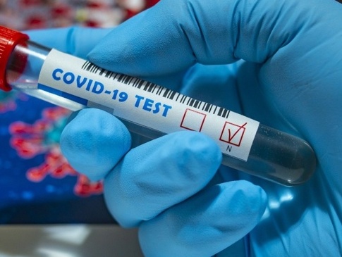 В Україні за добу виявили 656 хворих на коронавірус
