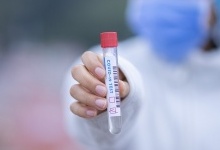 У МОЗ звітують про новий антирекорд з коронавірусу