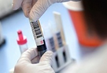 Дві українські лабораторії отримали мільйон на створення вакцини від коронавірусу