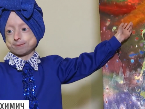 Дитина з тілом 80-річної: в Україні провели унікальну операцію дівчинці з хворобою передчасного старіння