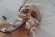 У Луцьку померла 32-річна багатодітна жінка, яку побив співмешканець