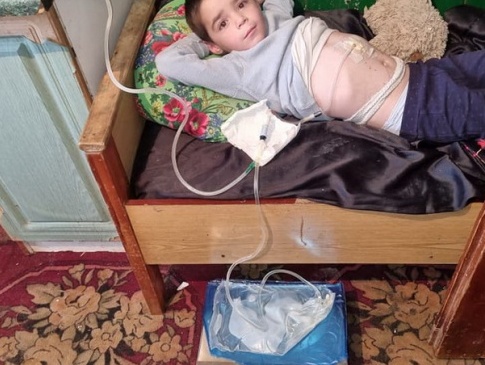 На Прикарпатті у 6-річного хлопчика з багатодітної родини відмовили обидві нирки