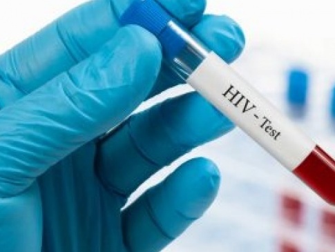 У Луцьку протягом одного дня безкоштовно робитимуть тестування на ВІЛ/СНІД та гепатит С