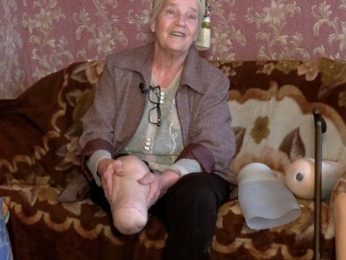 Щемлива історія жінки з-під Чернігова, яка втратила ногу через звірства рф