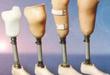 На Волині є можливість безкоштовно виготовляти протези для бійців АТО