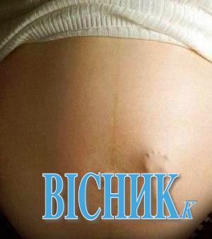 У Луцьку агресивний чоловік убив немовля в утробі жінки і вона втратила здатність народжувати