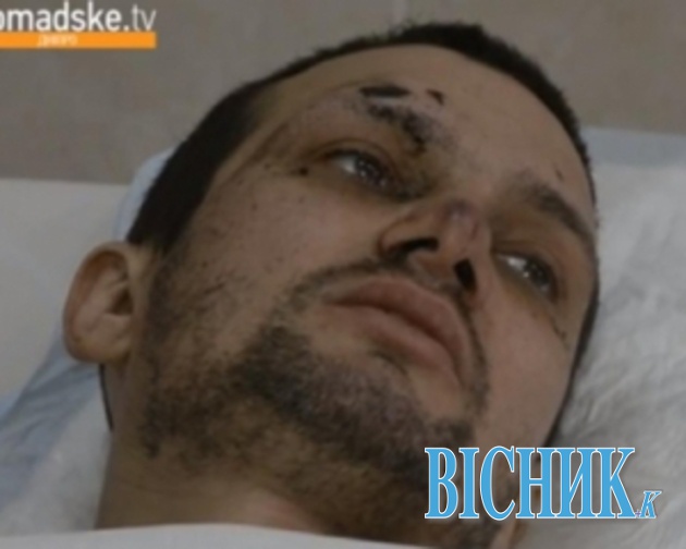 Поранений український військовий медик вижив, пролежавши на морозі під Дебальцевим три дні