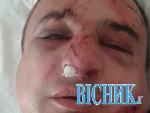 У Києві побили луганського сепаратиста Клінчаєва