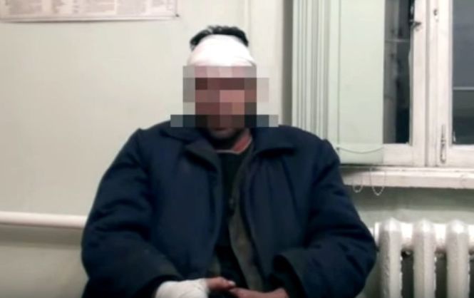 До українських військових втік раб з «ДНР» — за погану роботу йому прострелили ногу і пробили ножем руку