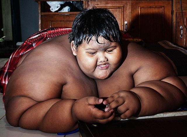 10-річного індонезійця, який заважив два центнери, силою посадили на дієту