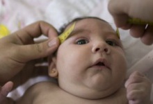 У США народилася перша дитина, яка постраждала від вірусу Зіка