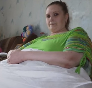 Хвора жінка важить… 350 кілограмів