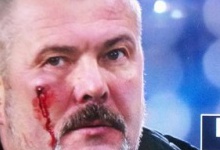 Фанати «Дніпра» побили нардепа Юрія Березу
