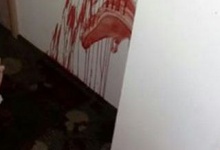 У Росії 80-річна жінка порізала сплячих сусідок по палаті – виганяла бісів