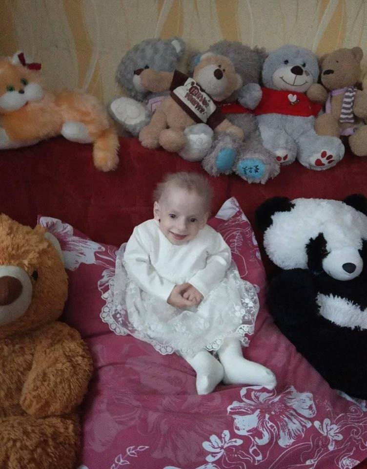 Семирічні дівчатка з тілом 60-річних: в Україні - двоє діток із хворобою передчасного старіння