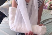 На атракціоні в луцькому парку дитина зламала руку