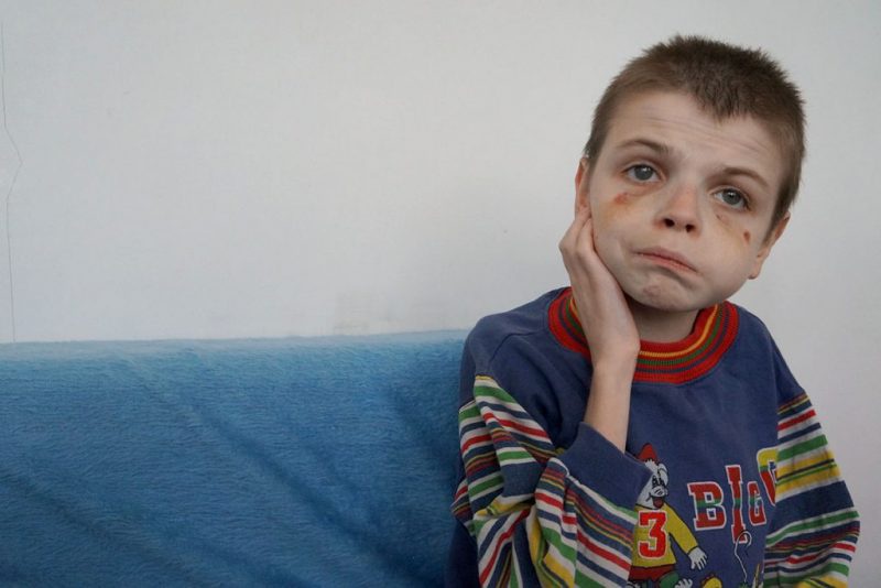 Мордування дітей у притулку в Ужгороді: відкрили ще два кримінальні провадження