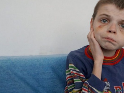 Мордування дітей у притулку в Ужгороді: відкрили ще два кримінальні провадження