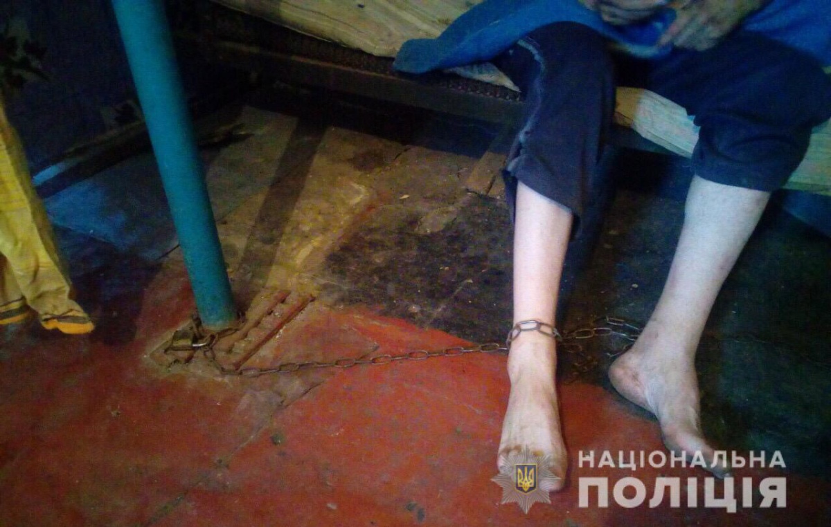 На Дніпропетровщині горе-матір тримала хворого сина на ланцюзі