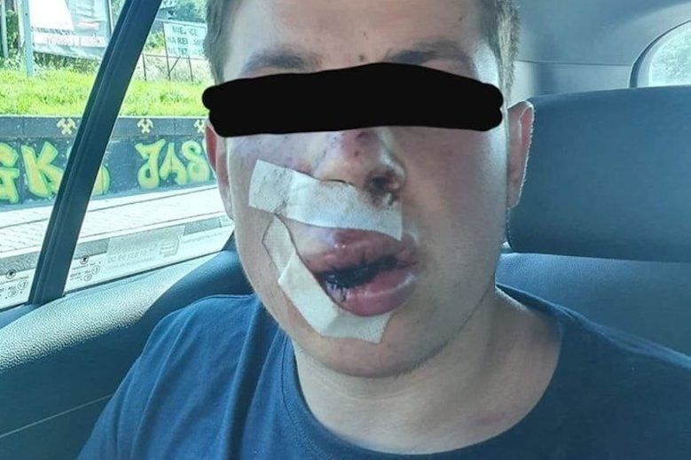 У Польщі жорстоко побили студента, бо він з України