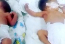 У Запоріжжі 15-річна народила двійню: малюки у реанімації