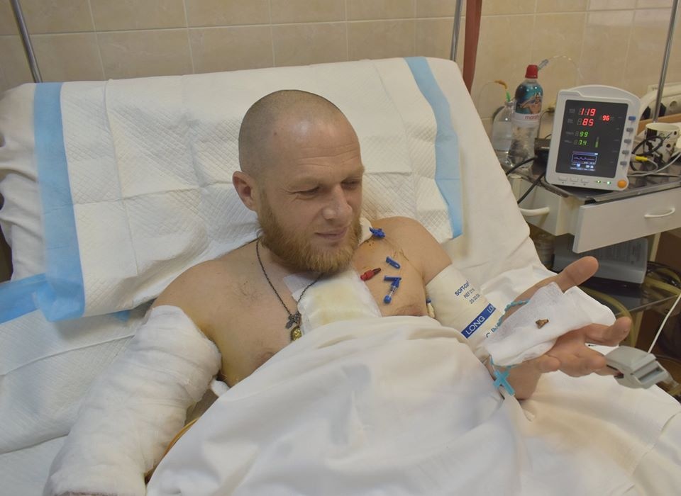 Втратив 2 літри крові: У Дніпрі лікарі врятували життя бійцю з Луцька
