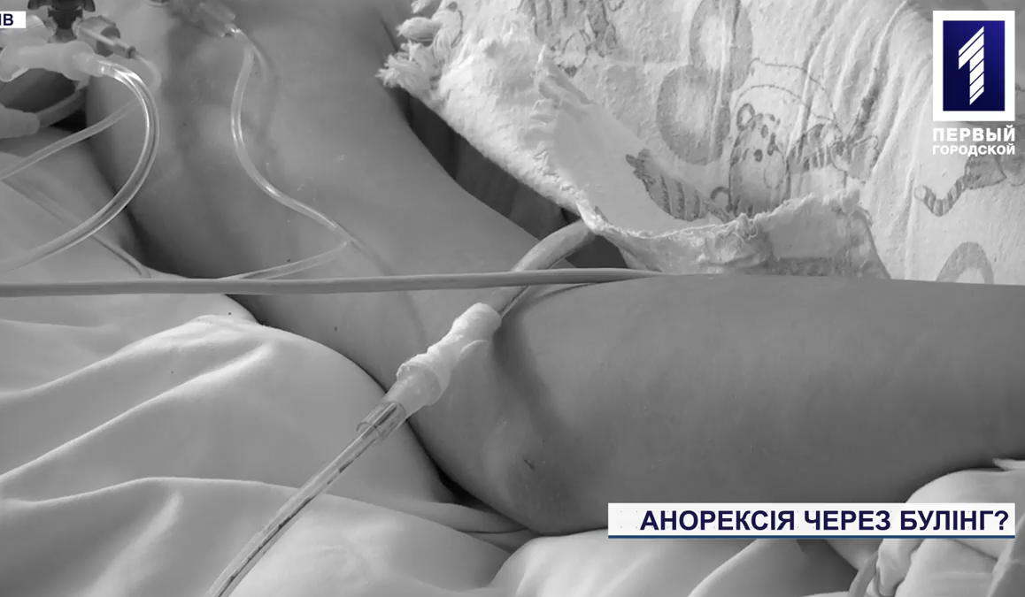 Пила воду і їла лише фрукти: на Дніпропетровщині школярка потрапила до лікарні з анорексією