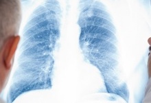 Хворих на туберкульоз волинян обслуговуватимуть сімейні лікарі