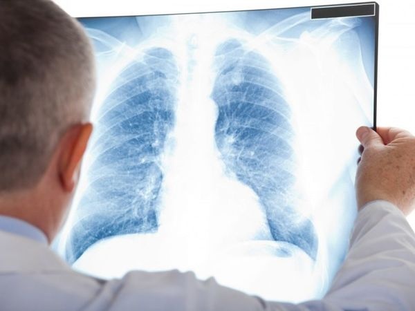 12 волинських медзакладів заявили про готовність лікувати пацієнтів з туберкульозом